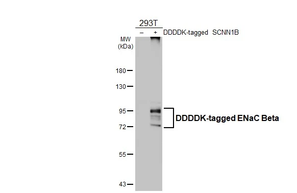 Non-transfected (–) and transfected (+) 293T whole cell extracts (30 μg) were separated by 7.5% SDS-PAGE, and the membrane was blotted with ENaC Beta antibody [N2C1], Internal (GTX108842) diluted at 1:5000. The HRP-conjugated anti-rabbit IgG antibody (GTX213110-01) was used to detect the primary antibody.