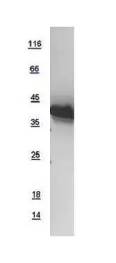10ug of GTX108859-pro USP12 recombinant protein analyzed using SDS-PAGE and stained with coomassie blue and captured by black and white camera.