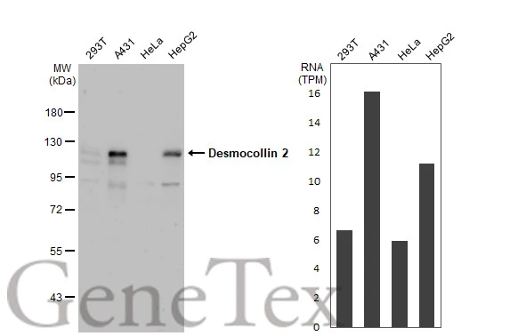 Various whole cell extracts (30 μg) were separated by 7.5% SDS-PAGE, and the membrane was blotted with Desmocollin 2 antibody [C1C2], Internal (GTX108888) diluted at 1:500. The HRP-conjugated anti-rabbit IgG antibody (GTX213110-01) was used to detect the primary antibody. Corresponding RNA expression data for the same cell lines are based on Human Protein Atlas program.