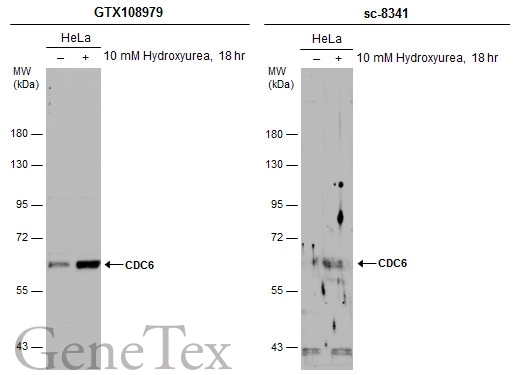 Untreated (–) and treated (+) HeLa whole cell extracts (30 μg) were separated by 7.5% SDS-PAGE, and the membranes were blotted with CDC6 antibody (GTX108979) diluted at 1:500 and competitor's antibody (sc-8341) diluted at 1:100. The HRP-conjugated anti-rabbit IgG antibody (GTX213110-01) was used to detect the primary antibody. Untreated (–) and treated (+) HeLa whole cell extracts (30 μg) were separated by 7.5% SDS-PAGE, and the membranes were blotted with CDC6 antibody (GTX108979) diluted at 1:500 and competitor's antibody (sc-8341) diluted at 1:100. The HRP-conjugated anti-rabbit IgG antibody (GTX213110-01) was used to detect the primary antibody.