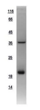 10ug of GTX108985-pro AGR3 recombinant protein analyzed using SDS-PAGE and stained with coomassie blue and captured by black and white camera.