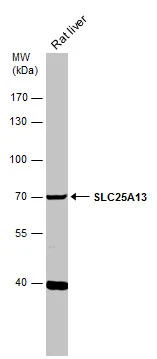 Rat tissue extract (50 μg) was separated by 7.5% SDS-PAGE, and the membrane was blotted with SLC25A13 antibody [N3C2], Internal (GTX109001) diluted at 1:500. The HRP-conjugated anti-rabbit IgG antibody (GTX213110-01) was used to detect the primary antibody.