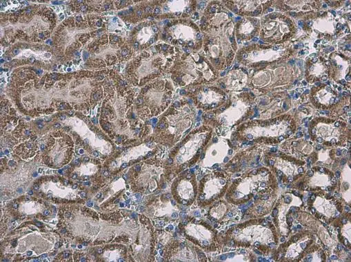 SLC25A13 antibody [N3C2], Internal detects SLC25A13 protein at cytoplasm in mouse kidney by immunohistochemical analysis. Sample: Paraffin-embedded mouse kidney. SLC25A13 antibody [N3C2], Internal (GTX109001) diluted at 1:500. 
 Antigen Retrieval: Citrate buffer, pH 6.0, 15 min