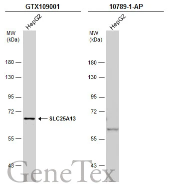 Whole cell extract (30 μg) was separated by 7.5% SDS-PAGE, and the membranes were blotted with SLC25A13 antibody [N3C2], Internal (GTX109001) diluted at 1:1000 and competitor's antibody (10789-1-AP) diluted at 1:1000. The HRP-conjugated anti-rabbit IgG antibody (GTX213110-01) was used to detect the primary antibody. *The competitor is not affiliated with GeneTex and does not endorse this product.