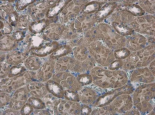 SLC25A13 antibody [N3C2], Internal detects SLC25A13 protein at cytoplasm in mouse kidney by immunohistochemical analysis. Sample: Paraffin-embedded mouse kidney. SLC25A13 antibody [N3C2], Internal (GTX109001) diluted at 1:500. 
 Antigen Retrieval: Citrate buffer, pH 6.0, 15 min
