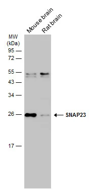 Various tissue extracts (50 μg) were separated by 12% SDS-PAGE, and the membrane was blotted with SNAP23 antibody (GTX109089) diluted at 1:1000. The HRP-conjugated anti-rabbit IgG antibody (GTX213110-01) was used to detect the primary antibody.