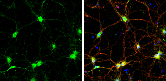 SNAP23 antibody detects SNAP23 protein at cell body and synaptic vesicles by immunofluorescent analysis. Sample: DIV9 rat E18 primary cortical neurons were fixed in 4% paraformaldehyde at RT for 15 min. Green: SNAP23 protein stained by SNAP23 antibody (GTX109089) diluted at 1:500. Red: beta Tubulin 3/ Tuj1, a neuron cell marker, stained by beta Tubulin 3/ Tuj1 antibody [GT11710] (GTX631836) diluted at 1:500. Blue: Fluoroshield with DAPI (GTX30920).