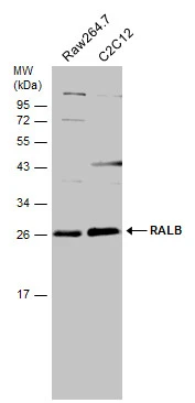 Various whole cell extracts (30 μg) were separated by 12% SDS-PAGE, and the membrane was blotted with RALB antibody [N1C3] (GTX109101) diluted at 1:500.