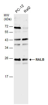 Various whole cell extracts (30 μg) were separated by 12% SDS-PAGE, and the membrane was blotted with RALB antibody [N1C3] (GTX109101) diluted at 1:500.
