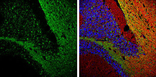 immune ビスチェ Anti-Synaptophysin antibody (GTX100865) | GeneTex