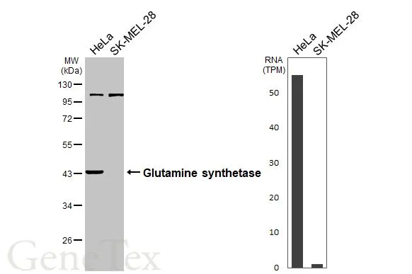Anti-Glutamine synthetase antibody (GTX109121) | GeneTex