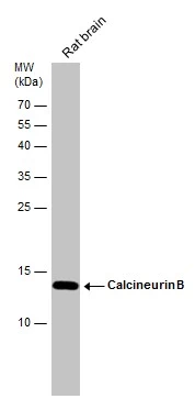 Calcineurin B antibody