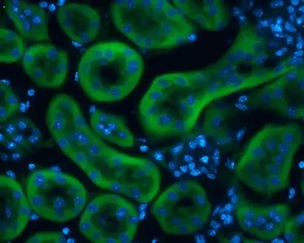 L-FABP antibody [N1C3] detects L-FABP protein at cytoplasm in rat kidney by immunohistochemical analysis. Sample: Frozen section of rat kidney. L-FABP antibody [N1C3] (GTX109142) diluted at 1:200.