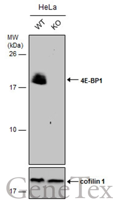 Wild-type (WT) and 4E-BP1 knockout (KO) HeLa cell extracts (30 μg) were separated by 15% SDS-PAGE, and the membrane was blotted with 4E-BP1 antibody [N1C3] (GTX109162) diluted at 1:500. The HRP-conjugated anti-rabbit IgG antibody (GTX213110-01) was used to detect the primary antibody.