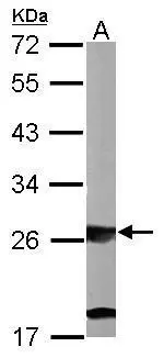 Sample (50 ug of whole cell lysate) A: mouse liver 12% SDS PAGE GTX109168 diluted at 1:1000 Sample (50 ug of whole cell lysate) A: mouse liver 12% SDS PAGE GTX109168 diluted at 1:1000