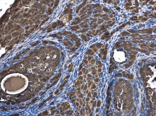 SAR1B antibody detects SAR1B protein at cytoplasm in mouse ovary by immunohistochemical analysis. Sample: Paraffin-embedded mouse ovary. SAR1B antibody (GTX109170) diluted at 1:500. 
 Antigen Retrieval: Citrate buffer, pH 6.0, 15 min