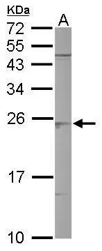 Sample (50 μg of whole cell lysate) A: mouse brain 12% SDS PAGE GTX109170 diluted at 1:3000 The HRP-conjugated anti-rabbit IgG antibody (GTX213110-01) was used to detect the primary antibody.