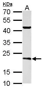 SAR1B antibody detects SAR1B protein by western blot analysis. A. 50 μg rat brain lysate/extract 12% SDS-PAGE SAR1B antibody (GTX109170) dilution: 1:3000 The HRP-conjugated anti-rabbit IgG antibody (GTX213110-01) was used to detect the primary antibody.