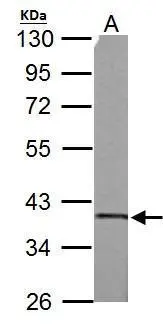 SUCLG1 antibody detects SUCLG1 protein by western blot analysis. A.50 μg rat brain lysate/extract 10% SDS-PAGE SUCLG1 antibody (GTX109215) dilution: 1:3000 The HRP-conjugated anti-rabbit IgG antibody (GTX213110-01) was used to detect the primary antibody.