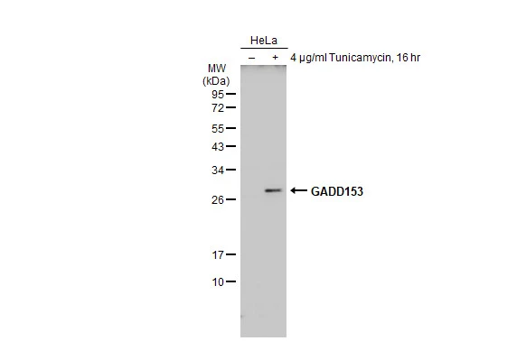 Untreated (–) and treated (+) HeLa whole cell extracts (30 μg) were separated by 12% SDS-PAGE, and the membrane was blotted with GADD153 antibody (GTX109226) diluted at 1:500. The HRP-conjugated anti-rabbit IgG antibody (GTX213110-01) was used to detect the primary antibody.