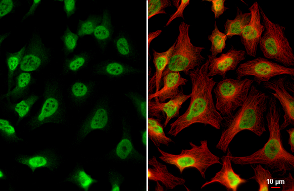 PDE6D antibody [N1C3] detects PDE6D protein at nucleus by immunofluorescent analysis. Sample: HeLa cells were fixed in 4% paraformaldehyde at RT for 15 min. Green: PDE6D stained by PDE6D antibody [N1C3] (GTX109240) diluted at 1:500. Red: alpha Tubulin, a cytoskeleton marker, stained by alpha Tubulin antibody [GT114] (GTX628802) diluted at 1:1000. Scale bar= 10μm.