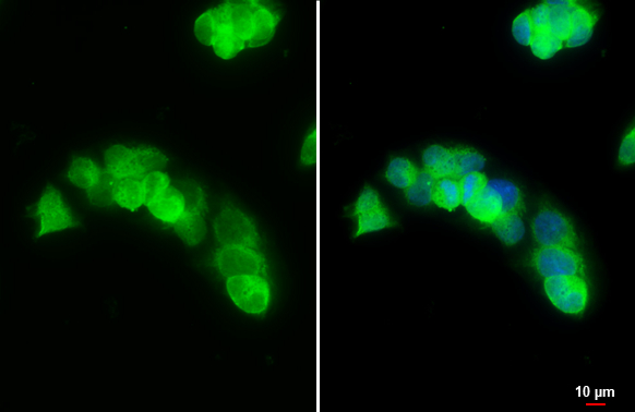 Arginase 1 antibody detects Arginase 1 protein at cytoplasm by immunofluorescent analysis. Sample: HepG2 cells were fixed in 4% paraformaldehyde at RT for 15 min. Green: Arginase 1 stained by Arginase 1 antibody (GTX109242) diluted at 1:500. Blue: Fluoroshield with DAPI (GTX30920). Scale bar= 10 μm.