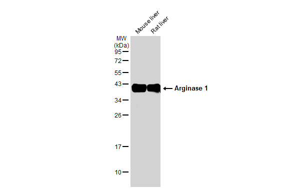 Various tissue extracts (50 μg) were separated by 12% SDS-PAGE, and the membrane was blotted with Arginase 1 antibody (GTX109242) diluted at 1:1000. The HRP-conjugated anti-rabbit IgG antibody (GTX213110-01) was used to detect the primary antibody.