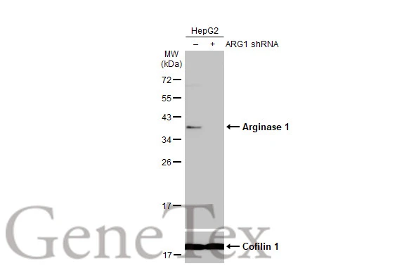 Non-transfected (–) and transfected (+) HepG2 whole cell extracts (30 μg) were separated by 12% SDS-PAGE, and the membrane was blotted with Arginase 1 antibody (GTX109242) diluted at 1:500. The HRP-conjugated anti-rabbit IgG antibody (GTX213110-01) was used to detect the primary antibody.