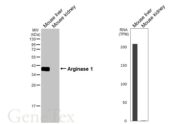 Anti-Arginase 1 antibody (GTX109242) | GeneTex