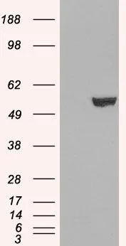 IHC-P analysis of human prostate using GTX10925 IRF6 antibody,C-term. Antigen retrieval : citrate buffer pH 6 Dilution : 5ug/ml