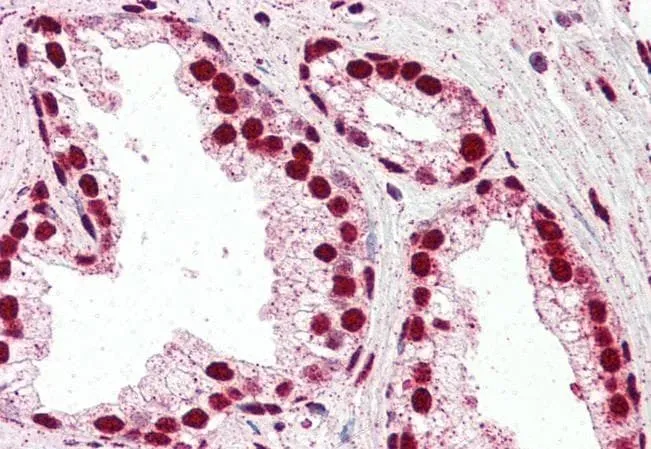 IHC-P analysis of human prostate using GTX10925 IRF6 antibody, C-term. Antigen retrieval : citrate buffer pH 6 Dilution : 5microg/ml