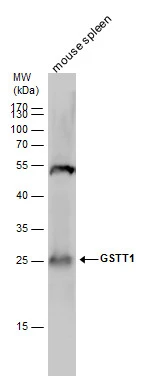 GSTT1 antibody detects GSTT1 protein by Western blot analysis. Mouse tissue extracts (50 μg) was separated by 12 % SDS-PAGE, and the membrane was blotted with GSTT1 antibody (GTX109250) diluted by 1:1000.