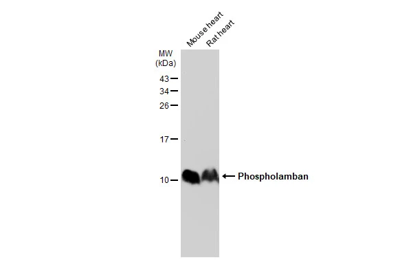 Various tissue extracts (50 μg) were separated by 15% SDS-PAGE, and the membrane was blotted with Phospholamban antibody (GTX109254) diluted at 1:10000. The HRP-conjugated anti-rabbit IgG antibody (GTX213110-01) was used to detect the primary antibody.