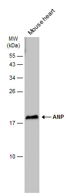 Mouse tissue extract (50 ug) was separated by 15% SDS-PAGE,and the membrane was blotted with ANP antibody (GTX109255) diluted at 1:5000. The HRP-conjugated anti-rabbit IgG antibody (GTX213110-01) was used to detect the primary antibody.