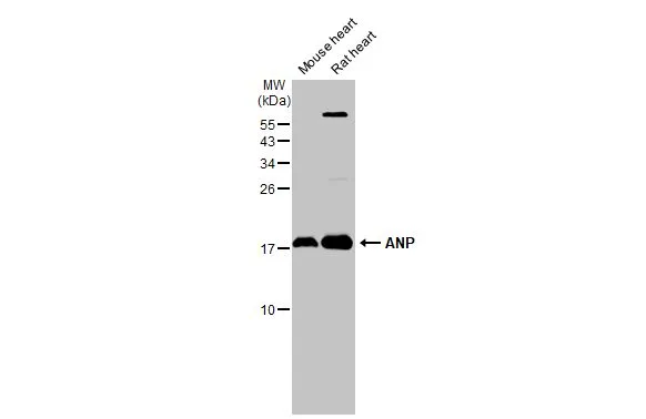 Various tissue extracts (50 μg) were separated by 15% SDS-PAGE, and the membrane was blotted with ANP antibody (GTX109255) diluted at 1:2000. The HRP-conjugated anti-rabbit IgG antibody (GTX213110-01) was used to detect the primary antibody.