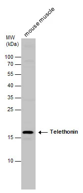 Telethonin antibody detects Telethonin protein by western blot analysis. Mouse tissue extracts (50 μg) was separated by 15% SDS-PAGE, and the membrane was blotted with Telethonin antibody (GTX109265) diluted at 1:500.