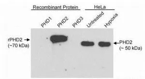 WB analysis of epitope-tagged PHD1,PHD2 or PHD3 (10 ng/lane) and hypoxia-treated HeLa cells lysate using GTX10930 PHD2 antibody. Dilution : 1 ug/ml