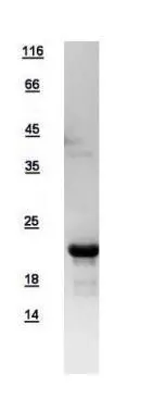 10ug of GTX109301-pro TTDN1 recombinant protein analyzed using SDS-PAGE and stained with coomassie blue and captured by black and white camera.