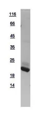 10ug of GTX109314-pro AP1S2 recombinant protein analyzed using SDS-PAGE and stained with coomassie blue and captured by black and white camera.