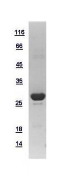 10ug of GTX109331-pro Troponin I (cardiac) recombinant protein analyzed using SDS-PAGE and stained with coomassie blue and captured by black and white camera.