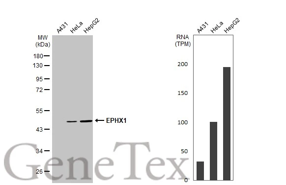 Various whole cell extracts (30 μg) were separated by 10% SDS-PAGE, and the membrane was blotted with EPHX1 antibody (GTX109360) diluted at 1:1000. The HRP-conjugated anti-rabbit IgG antibody (GTX213110-01) was used to detect the primary antibody. Corresponding RNA expression data for the same cell lines are based on Human Protein Atlas program.