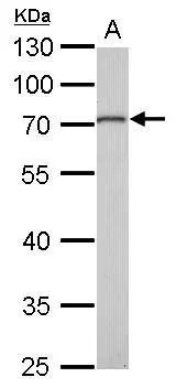 MMP16 antibody detects MMP16 protein by Western blot analysis. A. 50 μg mouse kidney lysate/extract 10 % SDS-PAGE MMP16 antibody (GTX109378) dilution: 1:1000 MMP16 antibody detects MMP16 protein by Western blot analysis. A. 50 μg mouse kidney lysate/extract 10 % SDS-PAGE MMP16 antibody (GTX109378) dilution: 1:1000
