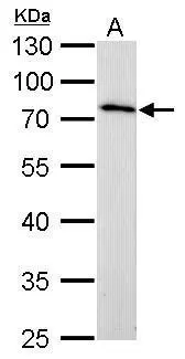 MMP16 antibody detects MMP16 protein by Western blot analysis. A. 50 μg rat kidney lysate/extract 10 % SDS-PAGE MMP16 antibody (GTX109378) dilution: 1:1000