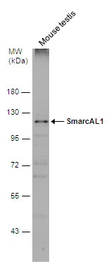 Mouse tissue extract (50 μg) was separated by 7.5% SDS-PAGE, and the membrane was blotted with SmarcAL1 antibody (GTX109468) diluted at 1:500. The HRP-conjugated anti-rabbit IgG antibody (GTX213110-01) was used to detect the primary antibody.