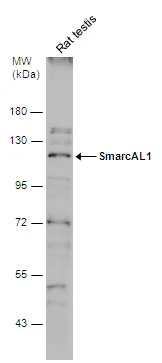 Rat tissue extract (50 μg) was separated by 7.5% SDS-PAGE, and the membrane was blotted with SmarcAL1 antibody (GTX109468) diluted at 1:500. The HRP-conjugated anti-rabbit IgG antibody (GTX213110-01) was used to detect the primary antibody.