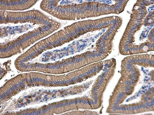 Cytokeratin 8 antibody [N1N3] detects Cytokeratin 8 protein at cytoplasm and membrane in mouse duodenum by immunohistochemical analysis. Sample: Paraffin-embedded mouse duodenum. Cytokeratin 8 antibody [N1N3] (GTX109489) diluted at 1:500. 
 Antigen Retrieval: Citrate buffer, pH 6.0, 15 min