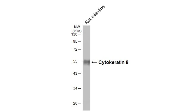 Rat tissue extract (50 μg) was separated by 10% SDS-PAGE, and the membrane was blotted with Cytokeratin 8 antibody [N1N3] (GTX109489) diluted at 1:1000. The HRP-conjugated anti-rabbit IgG antibody (GTX213110-01) was used to detect the primary antibody.