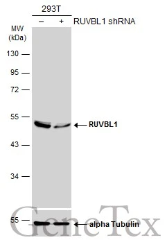 Non-transfected (–) and transfected (+) 293T whole cell extracts (30 μg) were separated by 10% SDS-PAGE, and the membrane was blotted with RUVBL1 antibody (GTX109494) diluted at 1:1000. The HRP-conjugated anti-rabbit IgG antibody (GTX213110-01) was used to detect the primary antibody. Non-transfected (–) and transfected (+) 293T whole cell extracts (30 μg) were separated by 10% SDS-PAGE, and the membrane was blotted with RUVBL1 antibody (GTX109494) diluted at 1:1000. The HRP-conjugated anti-rabbit IgG antibody (GTX213110-01) was used to detect the primary antibody.