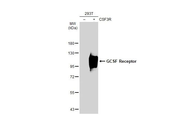 Non-transfected (–) and transfected (+) 293T whole cell extracts (30 μg) were separated by 7.5% SDS-PAGE, and the membrane was blotted with GCSF Receptor antibody [N2C1], Internal (GTX109503) diluted at 1:500. The HRP-conjugated anti-rabbit IgG antibody (GTX213110-01) was used to detect the primary antibody.