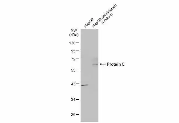 HepG2 whole cell extract and conditioned medium (30 μg) were separated by 10% SDS-PAGE, and the membrane was blotted with Protein C antibody (GTX109504) diluted at 1:1000. The HRP-conjugated anti-rabbit IgG antibody (GTX213110-01) was used to detect the primary antibody.